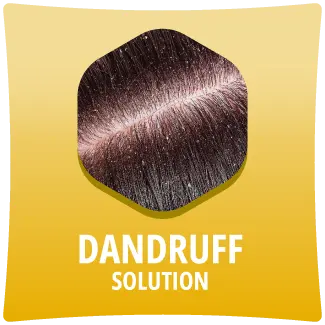 dandruff-solution